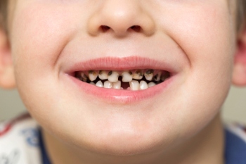 Council chiefs call for oral health investment image