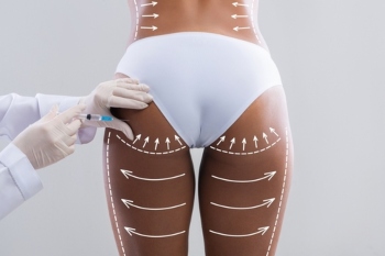 Council cracks down on ‘Brazilian Butt Lifts’  image