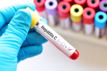 England sees ‘significant reduction’ in deaths from hepatitis C  image